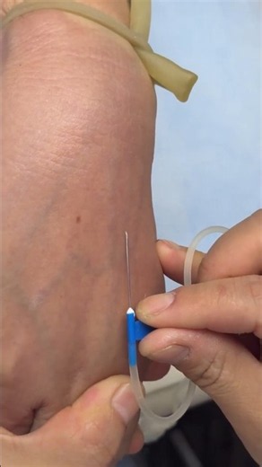 How to Give IV Injection Safely | Intravenous Nursing Skills | IV & Intramuscular IM injection:78