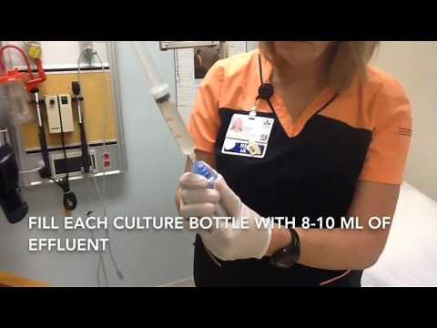 How to take PD peritonitis samples