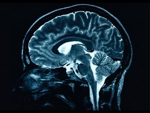 Every Neuron in a Brain Recorded in 3D on a Millisecond Timescale
