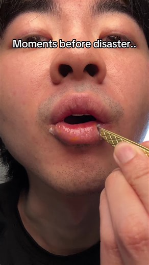 Ultimate Lip Care: Say Goodbye to Crusty Lips!