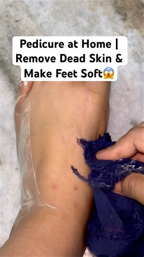 Pedicure at Home | Remove Dead Skin & Make Feet Soft😱 #pedicure#footcare#beautytips #ytshorts
