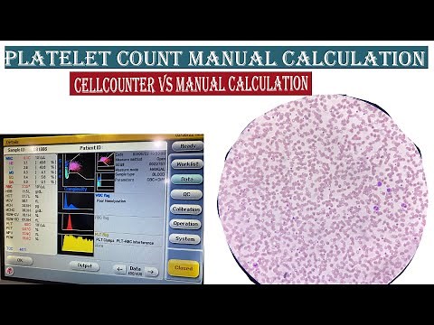 Platelet Count Manual Calculation ।। Cross Check Cellcounter Vs Slide Calculation.