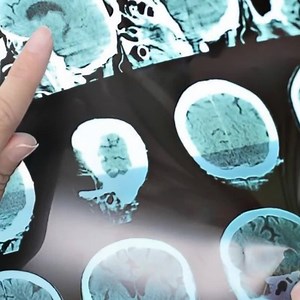 35K views · 649 reactions | MS is often unpredictable, and the warning signs can easily be mistaken for other conditions. But if someone experiences these 10 symptoms, it may be time to make an appointment with a doctor. | HealthVersed | Facebook