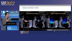 Optimizing TMVr: Lessons Learned from Advanced Imaging