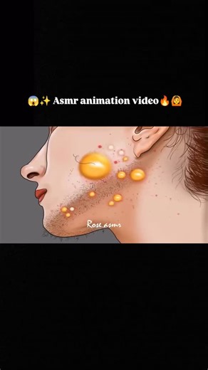 Rose Asmr | ✓ Follow @rose__asmr_ for more Asmr animation video. Follow | Share | Like #asmr #satisfying #slime #asmrvideo #explore #viralreel... | Instagram