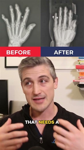What is your brain telling you through your hands?
