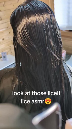 #hair #headlicetreatment #nits #headlice #kids #fyp #schoollife | Nit Nurse