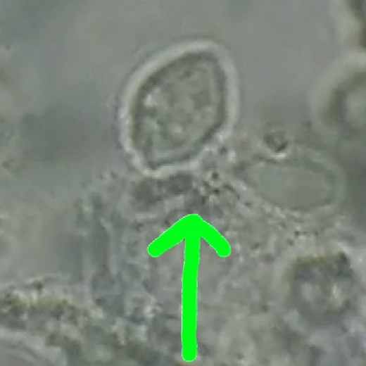 トリコモナス感染症ってどんな病気？症状やその原因と治療方法を解説します。 | 医療法人社団 予防会 - コラム・ニュースページ