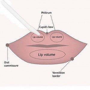 4.7M views · 1.8K reactions | "I began using City Lips regularly...