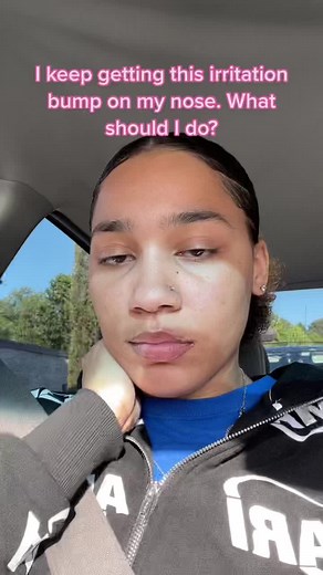 Dealing with an Irritation Bump on a Nose Piercing