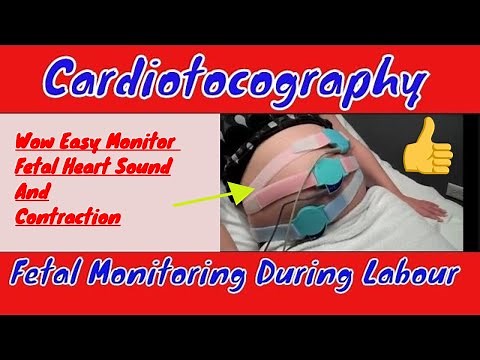 Cardiotocography | Medical Discovery