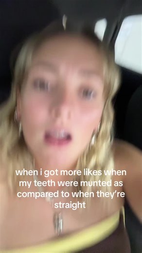 Munted Teeth vs. Straight Teeth: The Like Factor