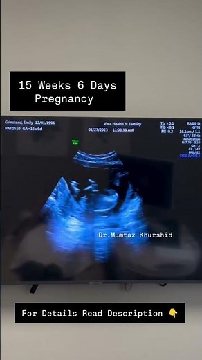 15 Weeks Baby On Ultrasound Scan in Pregnancy