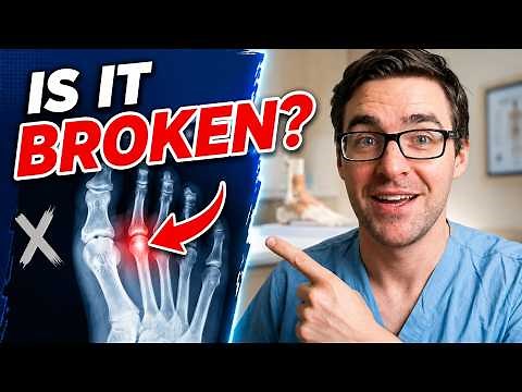 Is It Actually Broken? [Identifying Toe Injuries At Home]