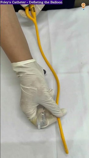 "Urinary Catheter Deflation: Step-by-Step Guide for Safe Removal 🚑💉"