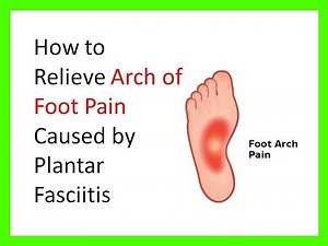 Arch of foot pain relief | Arch Foot Pain | Plantar Fasciitis | Bottom of Foot Pain