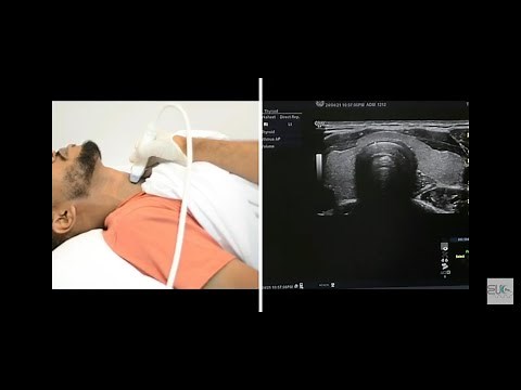 Thyroid Ultrasound Protocol