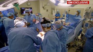 Baby Born With 2 Heads, 3 Hands In Rare Conjoined Twins Case