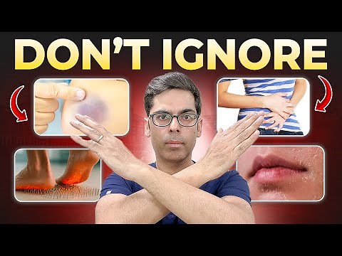Nutrient Deficiency Warning: Early Signs You Shouldn’t Ignore ( Doctor Explains)