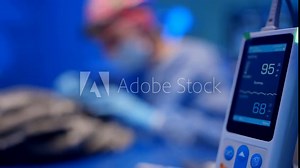 Close-up of the device showing vital signs during surgery. Safe operations under general anesthesia. High quality 4k footage