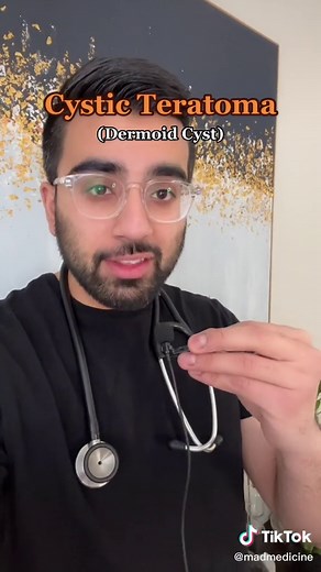 Ovarian Cysts with Hair and Teeth - Explained