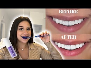 I TRIED THE TIKTOK FAMOUS PURPLE TOOTHPASTE TO WHITEN MY TEETH?!| hismile v34 purple teeth whitening
