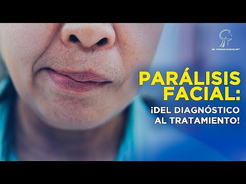 How to Recover Facial Movements After Paralysis.