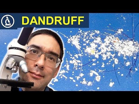 DANDRUFF under the microscope 🔬 Found on the keyboard