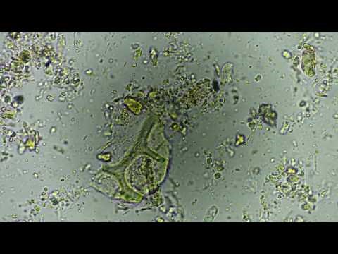 Trofozoito de chilomastix mesnili