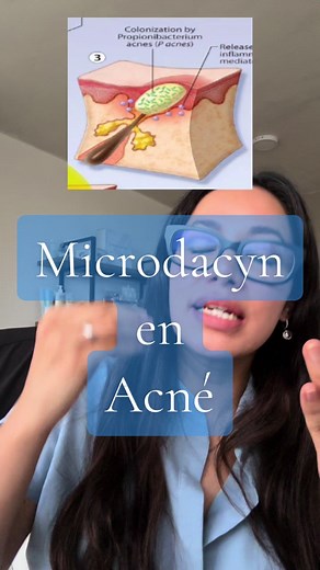Microdacyn y Almohadas: Tratamiento de Acne Efectivo