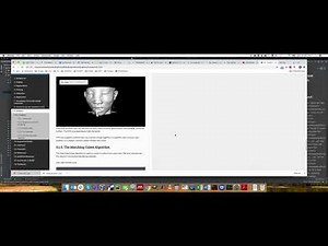 MPHY0026: Marching Cubes Explanation