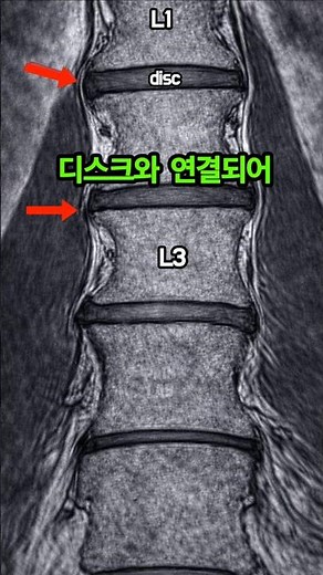 이래서 디스크가 터지는구나