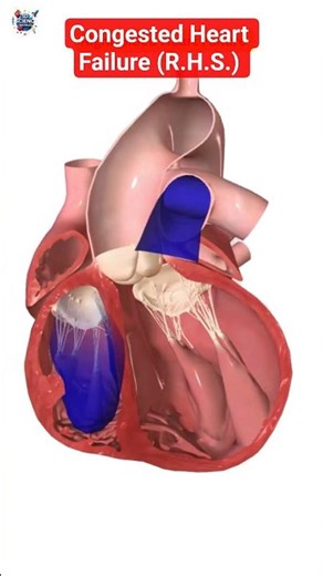 How Your Heart Actually Fails (3D Animation)