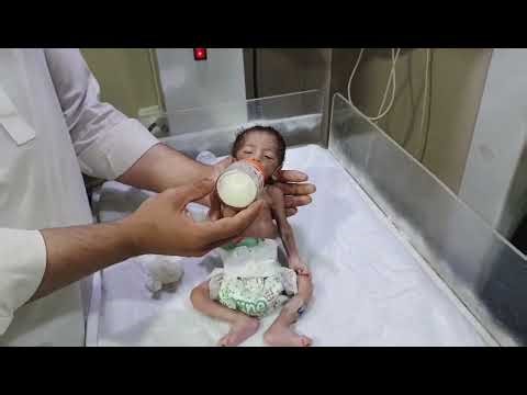 Newborn Baby First Feeding Trial | Safe First Feed Guide & How to Prepare Baby’s First Food