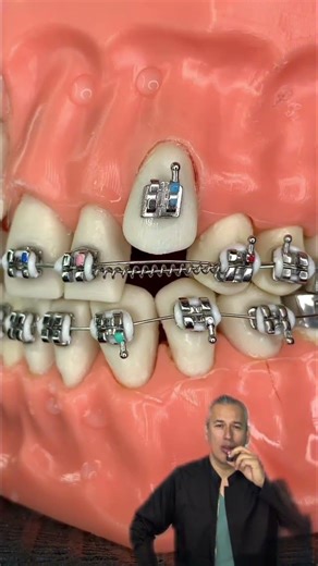 🔥Combining Forces with Brackets🔥