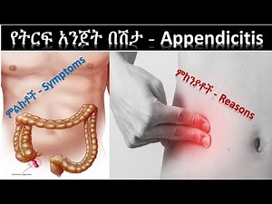 የትርፍ አንጀት በሽታ (መነሻ ምክንያቶች እና ምልክቶች) - Appendicitis (Causes & Symptoms)