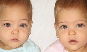 13 Years Ago They Were Called The World's Most Beautiful Twins – Now Look At Them