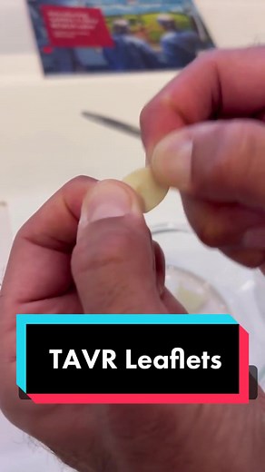 The latest upgrade to the Edwards Sapien Ultra TAVR valves is Resilia tissue. This is the same bovine tissue they use in there in their Inspiris valve. It is specially treated which enhances durability, reduces rates of calcification, and makes it almost impossible to tear as you can see here! Hopefully this will translate into a longer lifespan for these valves! #TAVR #Cardiology #Cardiologist #AorticStenosis #Cathlab #Medicine #cardiacsurgery #medtok