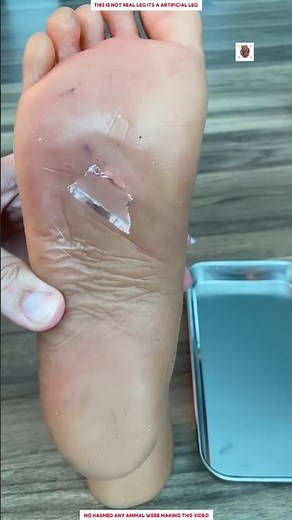 How to Safely Remove Broken Glass from Foot 😱