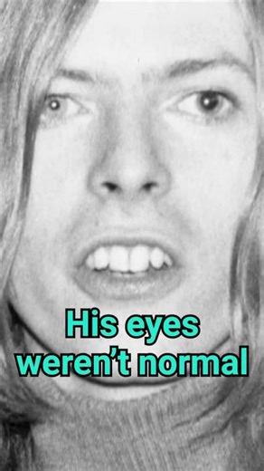 English medical term of the day: ANISOCORIA