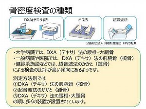 「骨密度検査からわかること」 放射線科