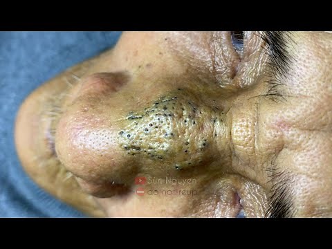 Satisfying and Relaxation with SURI NGUYEN Beauty Spa Video #244