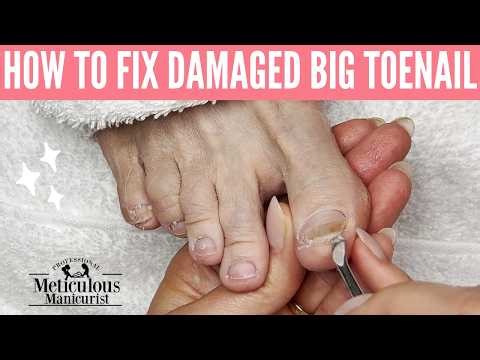 How to Fix Damaged Big Toenails: Pedicure Tutorial