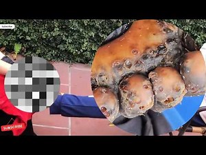 ⚡⚡REMOVE JIGGER Shocking 1309