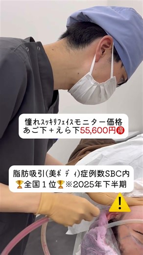 脂肪吸引5万円台ってお得すぎ🉐美ボディ脂肪吸引症例数全国１位🏆※2025年下半期SBC内