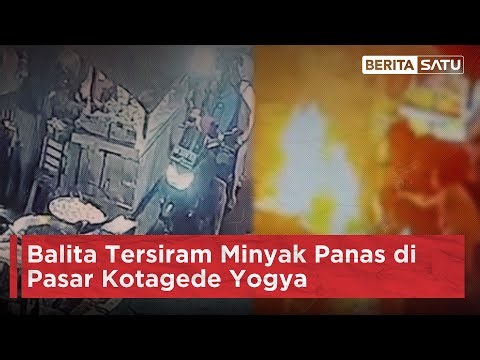 Balita Tersiram Minyak Panas di Pasar Kotagede Yogya | Beritasatu