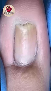 2K views · 16 reactions | 1026. Are checklist apps included in supportive coverage #DigitalWellness #HealthAccess #EverydayAffordability | Bye | Facebook