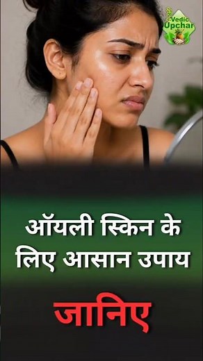 Oily Skin? Try These Natural Home Remedies | Vedic Upchar | @anilbansalayurveda | #OilySkin