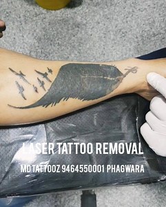 Get Rid of your unwanted tattoos . . Call 11 am to 7pm for your...