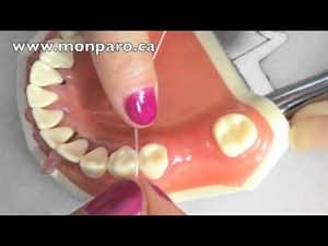 Technique sur comment passer le fil de soie, la soie dentaire - Dr Rania Azzi, Parodontiste